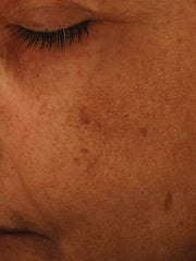 Close up of face before using product